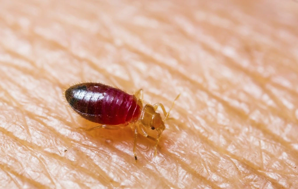 Bed bug bites on back