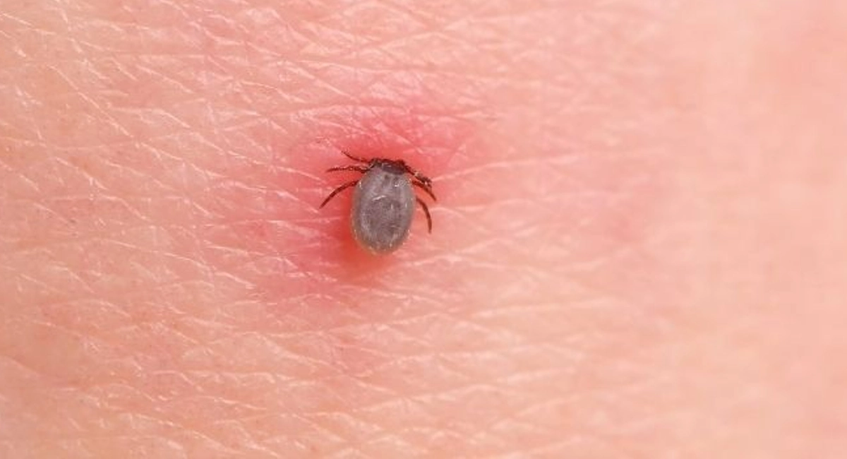 Human Fleas
