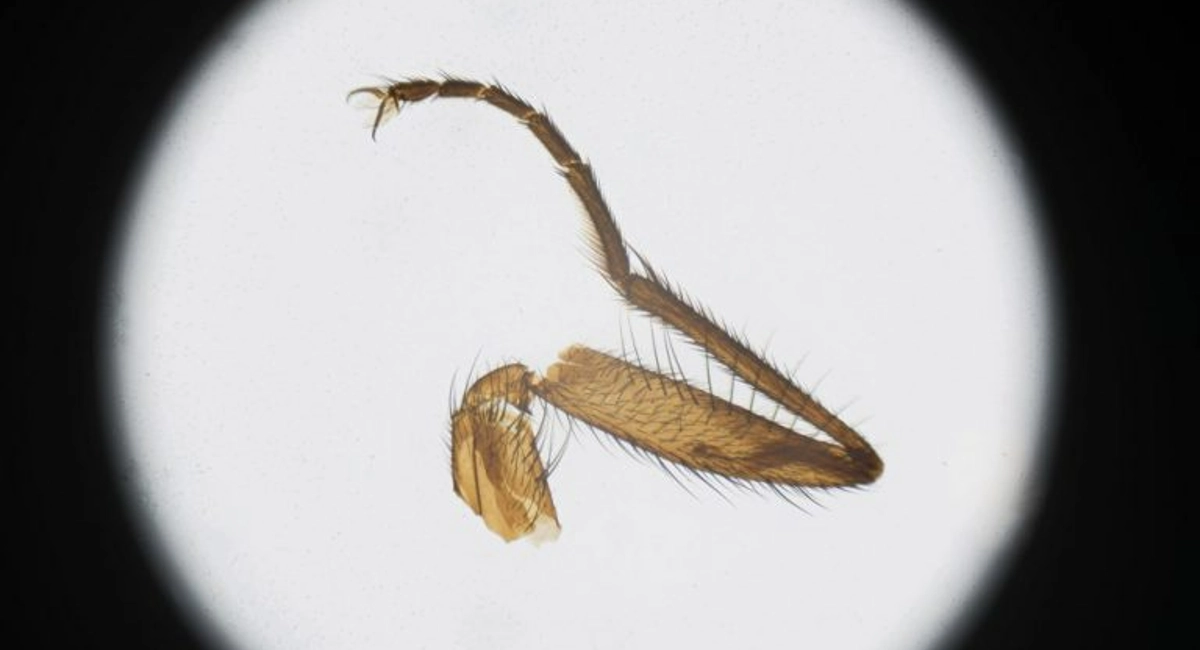 Microscopic photography of a housefly leg